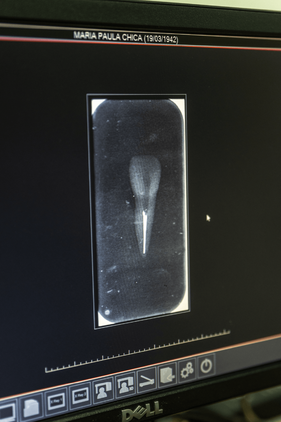 ADULT TEETH SET